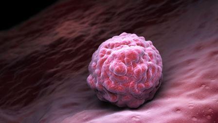Ученые выяснили, почему не работает лечение стволовыми клетками